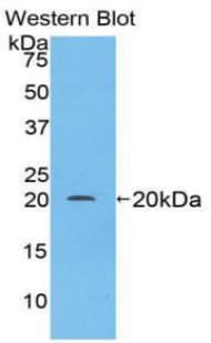 BCL2L2 / Bcl-w Antibody (aa11-171)