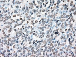 PLK1 / PLK-1 Antibody (clone OTI1A2)