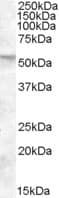 IHC-plus™ FKBP4 / FKBP52 Antibody (aa433-447)