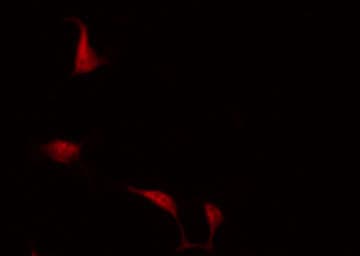 MAPKAPK3 Antibody