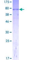 Human GLUD2 Protein (Recombinant GST, N-terminus)