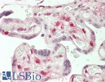 IHC-plus™ CBLB Antibody (aa450-500)