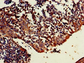 TRIM5 Antibody