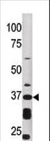 ART1 /CD296 Antibody (aa210-240)