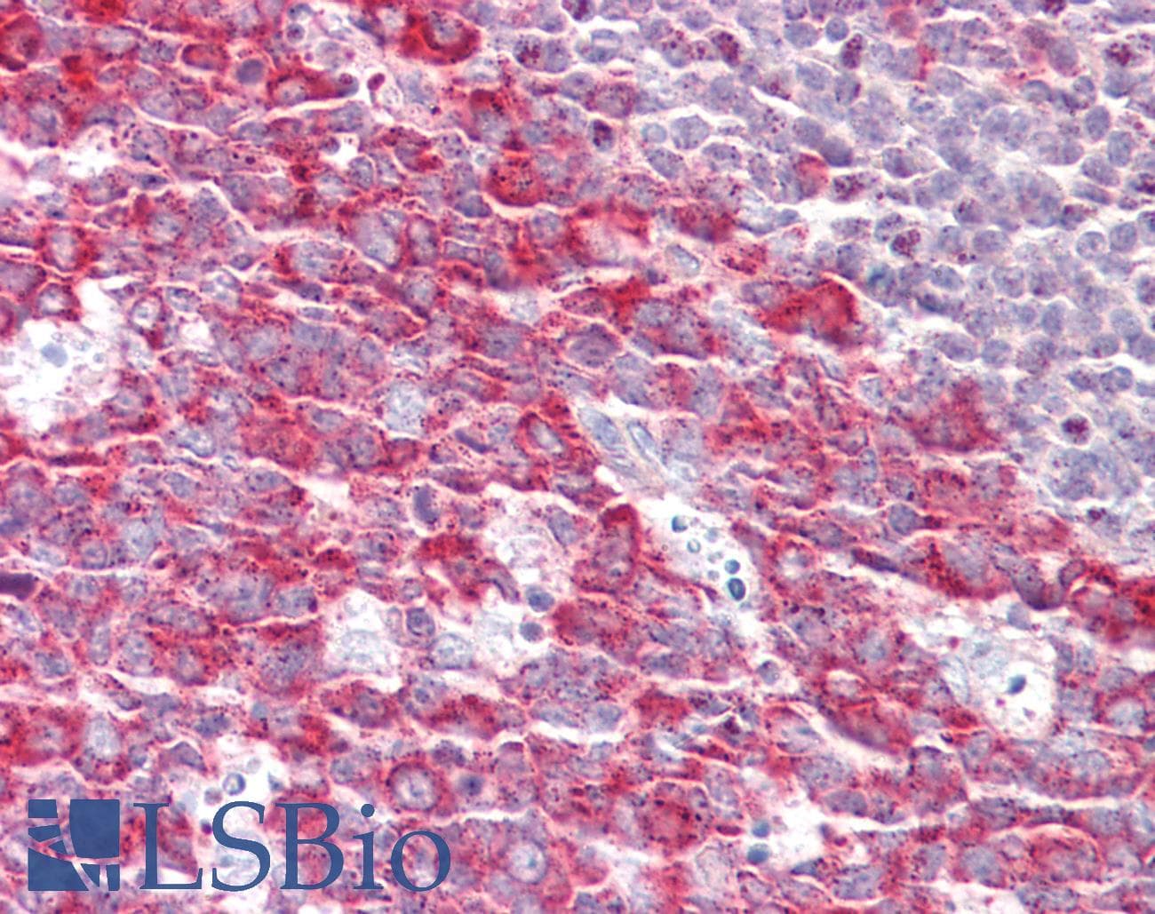 IHC-plus™ FMNL1 Antibody