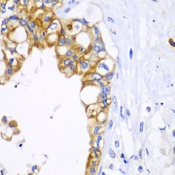 BCL2 / Bcl-2 Antibody