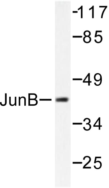JUNB / JUN-B Antibody (Asp253)