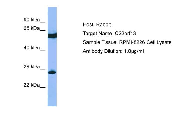 Polyclonal Rabbit anti-Human GUCD1 Antibody (aa81-130, WB)