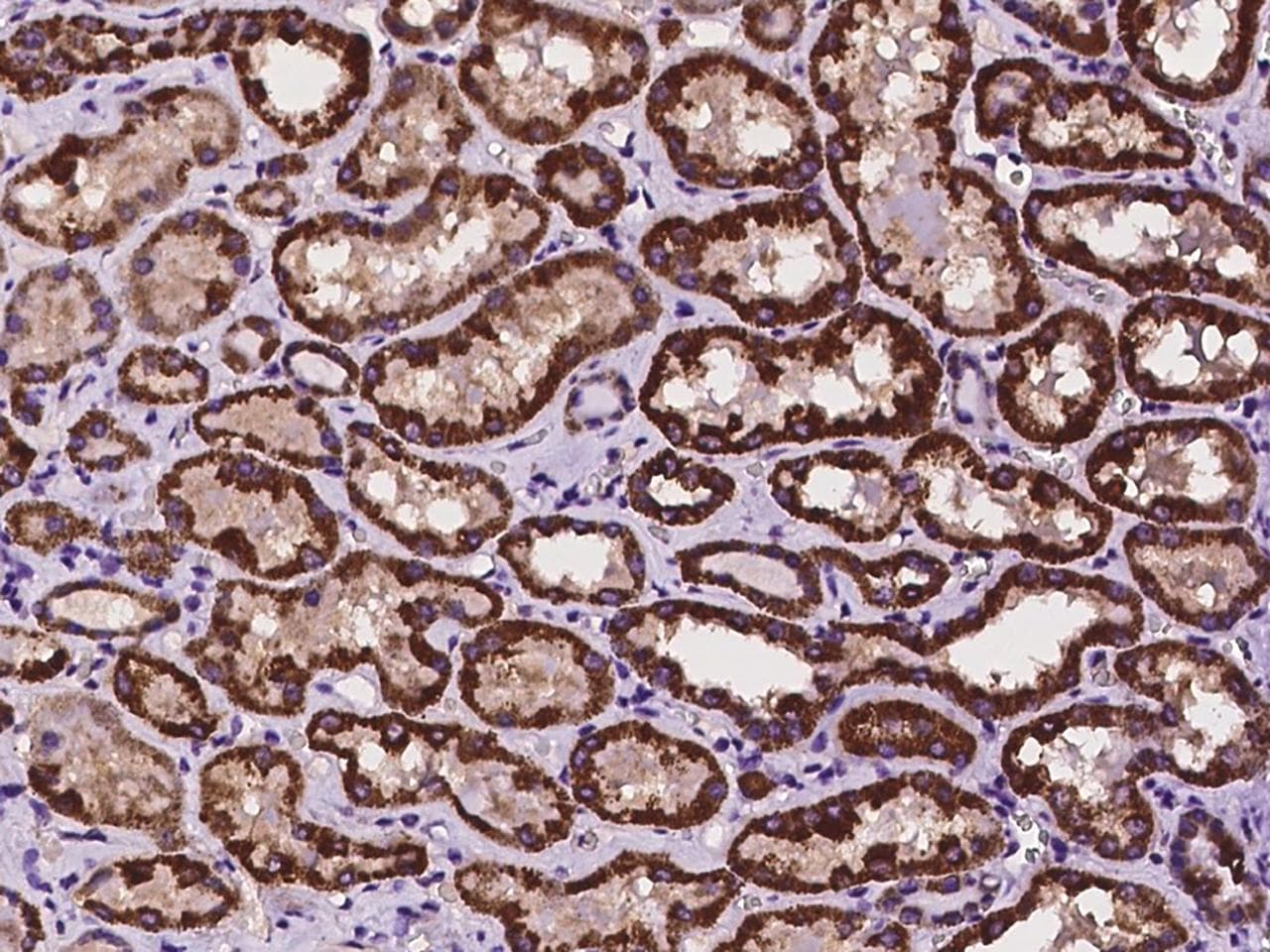 HOGA1 Antibody