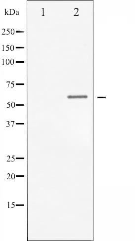 Polyclonal Rabbit anti-Human CHEK1 / CHK1 Antibody (phospho-Ser317, IHC, IF, WB)