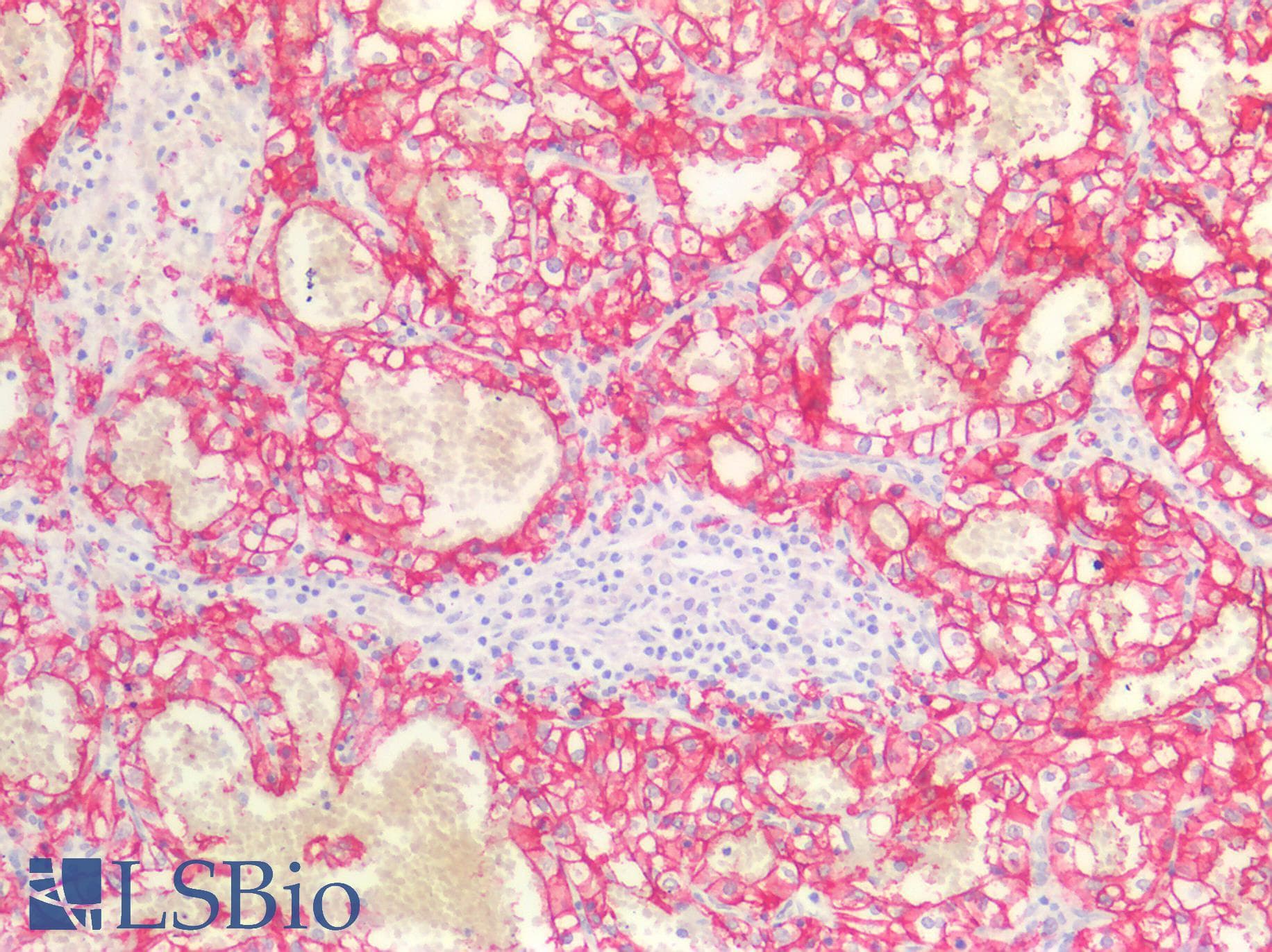IHC-plus™ Polyclonal Rabbit anti-Human CA9 / Carbonic Anhydrase IX Antibody (IHC, WB)