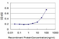 Monoclonal Mouse anti-Human FBL / FIB / Fibrillarin Antibody (clone 4G9-E4, IF, WB)