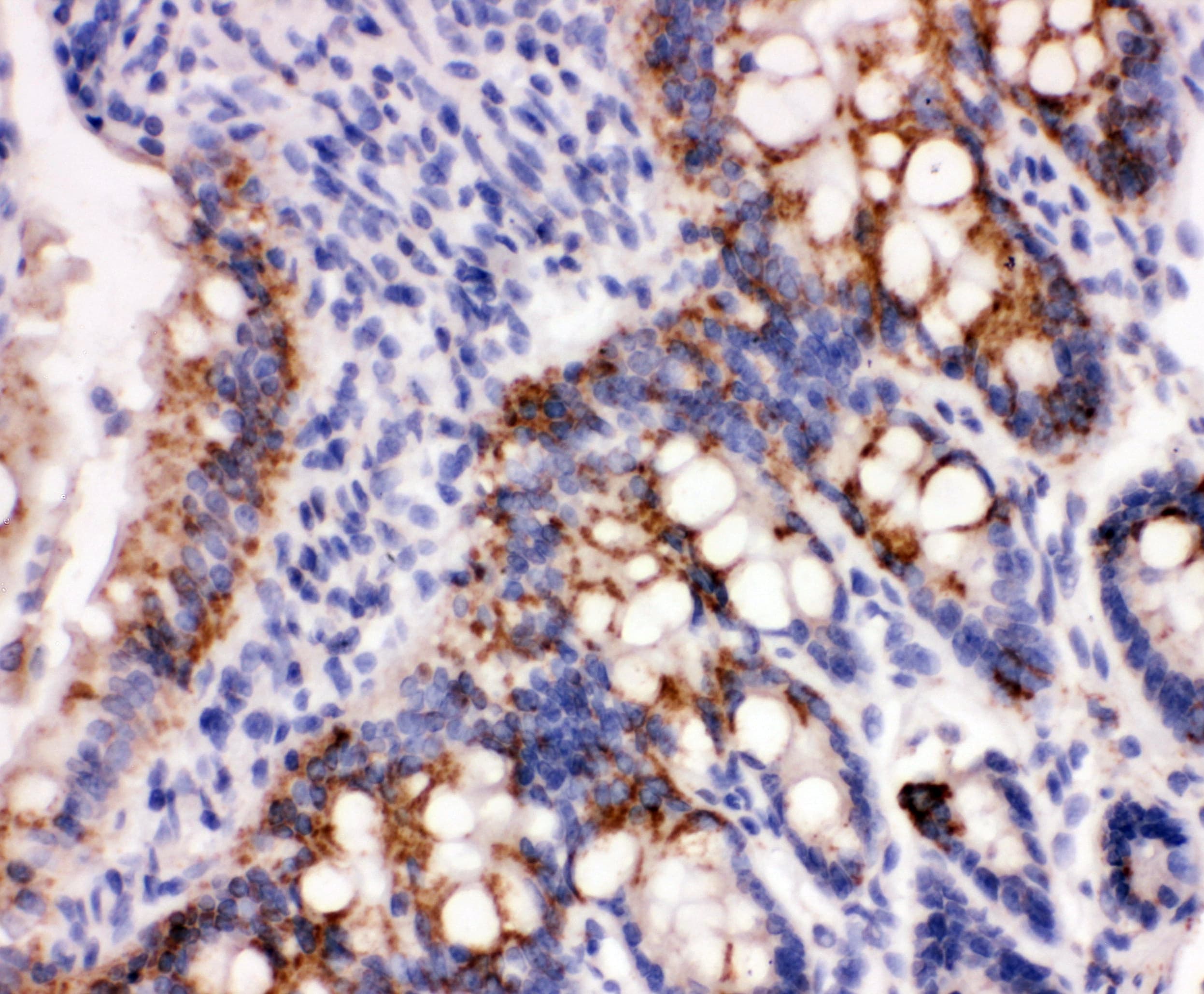Polyclonal Rabbit anti-Human PRDX3 / Peroxiredoxin 3 Antibody (aa239-256, IHC, WB)