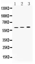 ATP4B Antibody