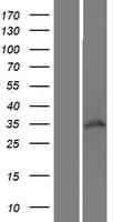 WDR82 / TMEM113 Protein (Over-Expression Lysate Myc-DDK (Flag))
