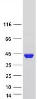 Human BEND6 Protein (Recombinant Myc-DDK (Flag))
