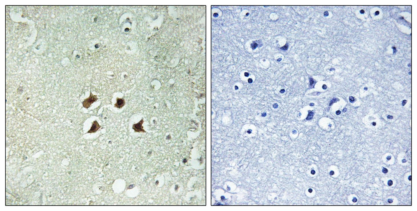 HTT / Huntingtin Antibody