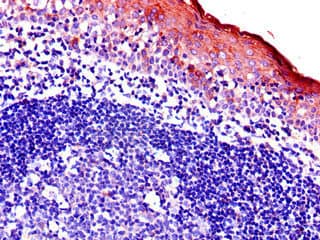 BIRC3 / cIAP2 Antibody