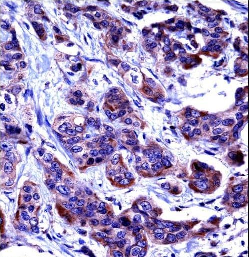 CASP6 / Caspase 6 Antibody (aa17-45)