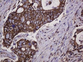 HSPD1 / HSP60 Antibody (clone OTI3G10)