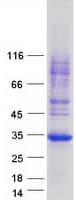 Human FAM156B Protein (Recombinant Myc-DDK (Flag))