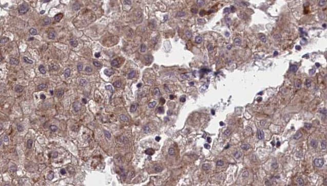 OR1L1 Antibody