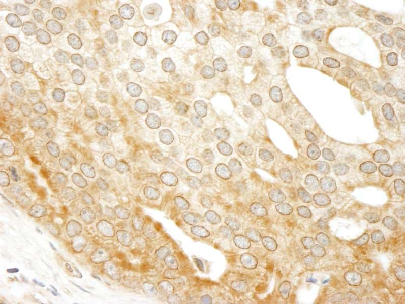 Polyclonal Rabbit anti-Human ABCF1 Antibody (aa795-845, IHC, WB)