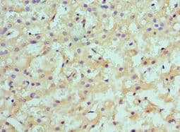 SULT2A1 / Sulfotransferase 2A1 Antibody (aa1-145)