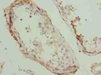 PLEKHJ1 Antibody