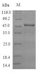 Human VASH2 Protein (Recombinant 6His-SUMO, N-terminus)