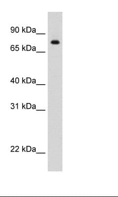 STAT1 Antibody (N-Terminus)