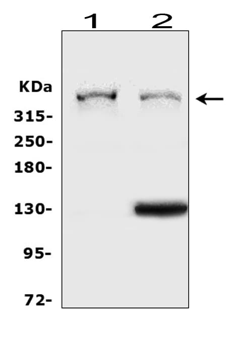Polyclonal Rabbit anti-Human HSPG2 / Perlecan Antibody (aa524-701, IHC, WB)