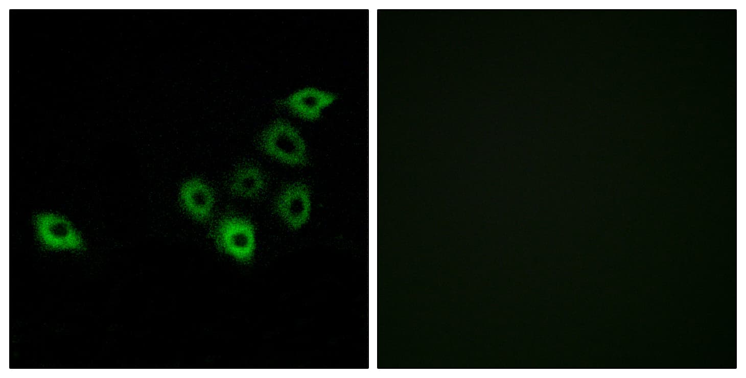 OR51S1 Antibody (aa211-260)