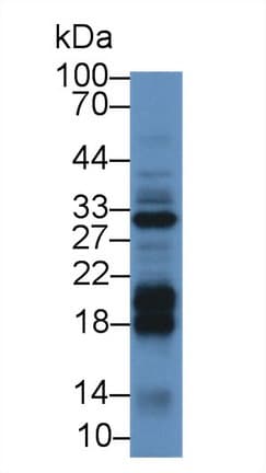 DGKA Antibody (aa305-531)
