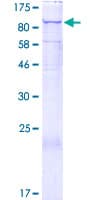 Human SART2 / DSE Protein (Recombinant GST)
