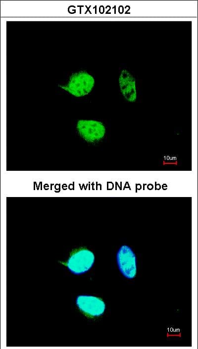 Polyclonal Rabbit anti-Human TCF25 Antibody (aa427-676, IHC, WB)