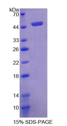 Mouse PDPN / Podoplanin Protein (Recombinant His-GST)