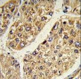CSGALNACT2 Antibody (aa200-229)