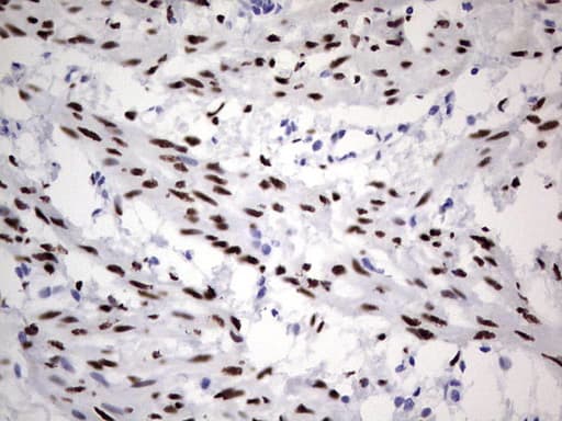 PR / Progesterone Receptor Antibody (aa1-298, clone OTI16H2, Carrier-free)
