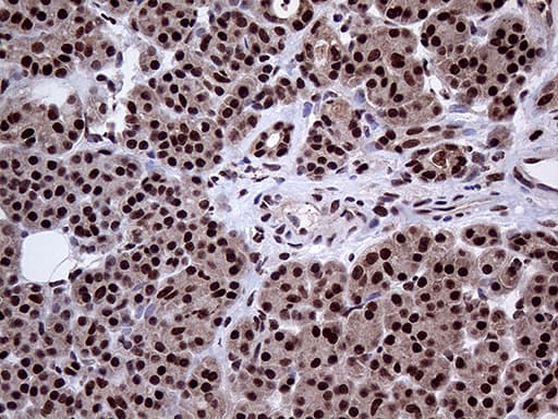 PPP4C Antibody (clone OTI2E4)