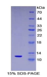 Human CCL15 / MIP5 Protein (Recombinant His)