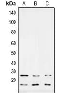 TGFB3 / TGF Beta3 Antibody (Internal)