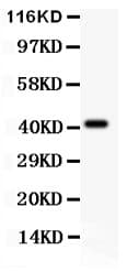 Polyclonal Rabbit anti-Human EDA / Ectodysplasin A Antibody (aa30-391, WB)