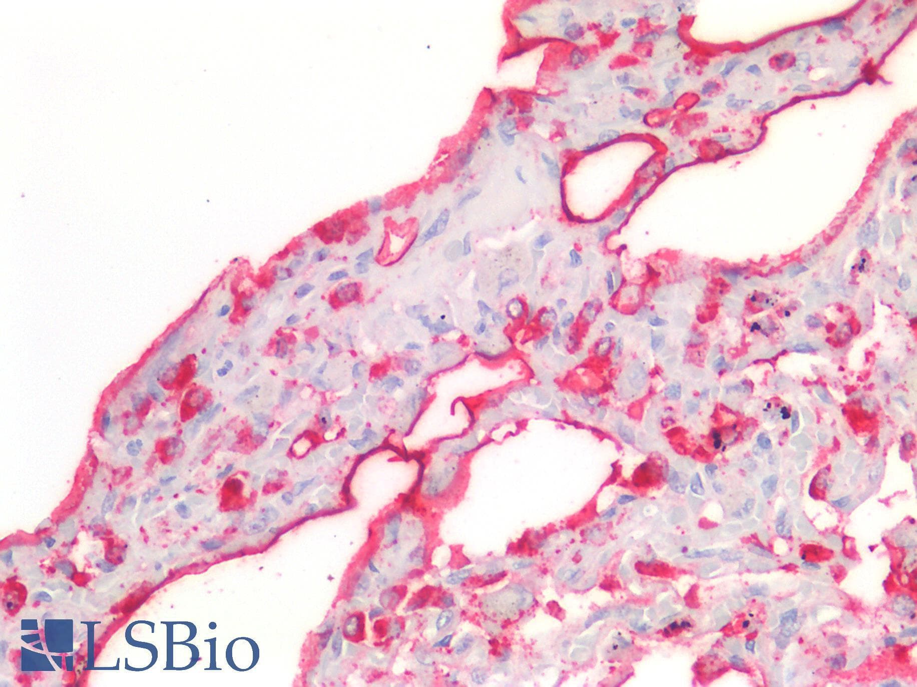 IHC-plus™ SFTPA1 / Surfactant Protein A Antibody