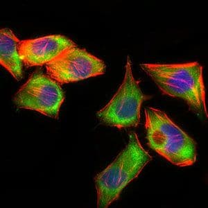Monoclonal Mouse anti-Human PSAP / Prosaposin Antibody (clone 4D5F4, Amino Acid: 325-524, IHC, IF, WB)