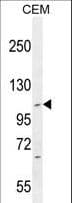IHC-plus™ TG737 / IFT88 Antibody (aa791-820)