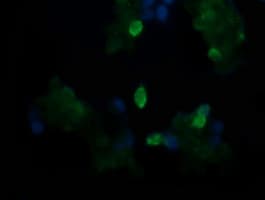 TAPBPL / TAPBPR Antibody (clone OTI2A4)