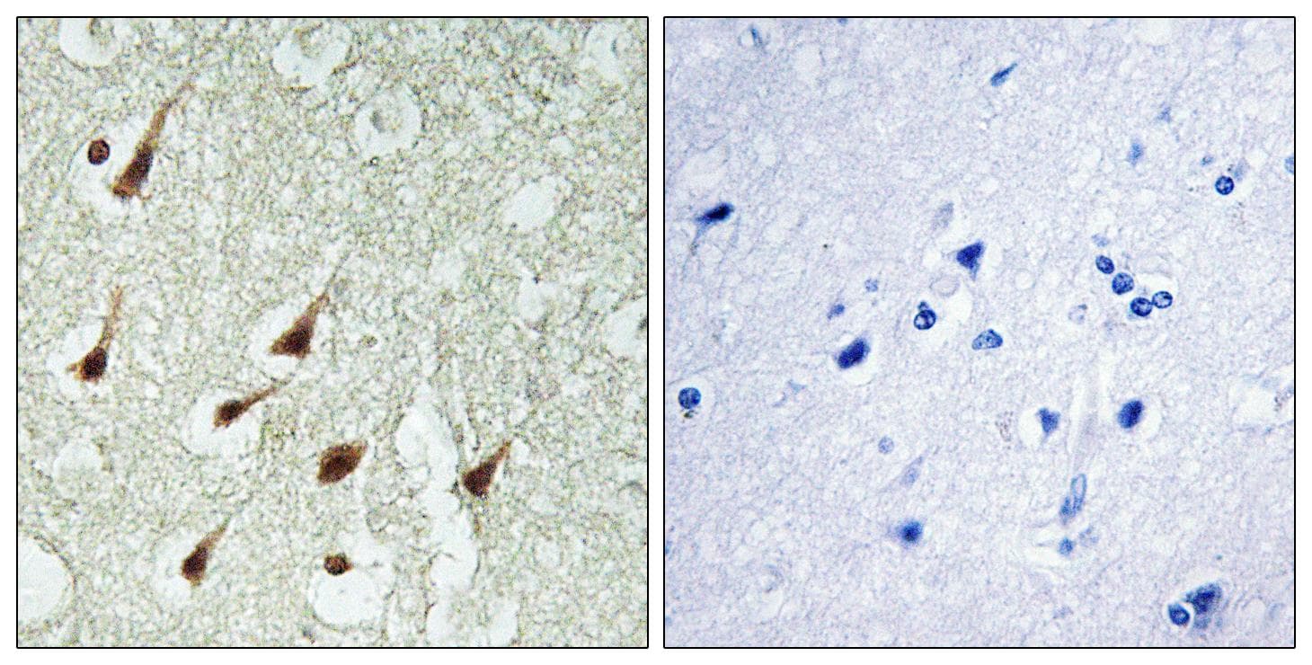 PRKCQ / PKC-Theta Antibody (Ab-695)