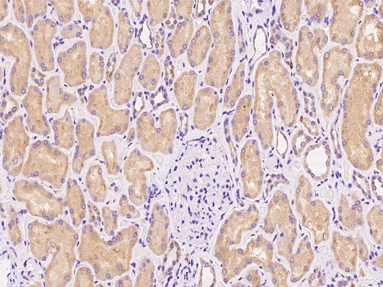 Polyclonal Rabbit anti-Human USE1 / p31 Antibody (IHC, IF, WB)
