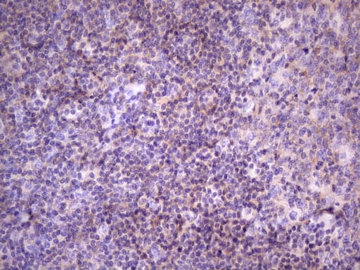 FBXO8 / FBX8 Antibody (aa1-231, clone OTI3C5)